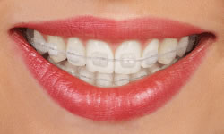 Cosmetic Dentistry - William MSchneider, DDS